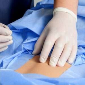 Minimally Invasive spine surgery saishree hospital pune