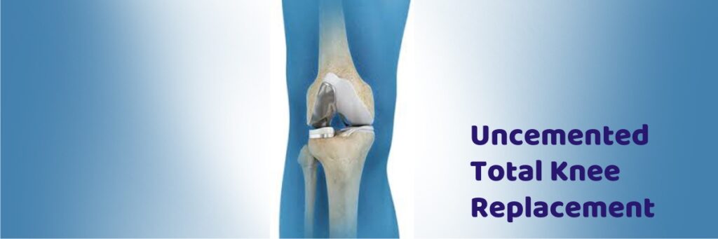 Uncemented Total Knee Replacement Saishree Hospital Pune