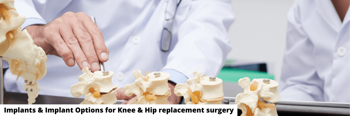 IMPLANTS & IMPLANT OPTIONS FOR KNEE & HIP REPLACEMENT SURGERY